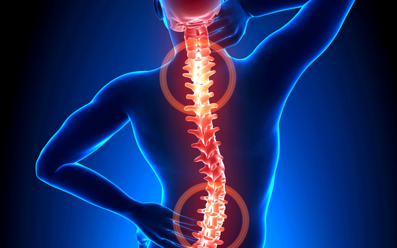 علائم تنگی کانال نخاعی کمر