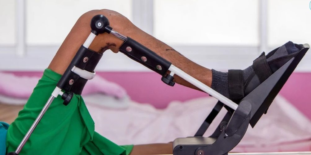 دستگاه سی پی ام (CPM) چیست؟