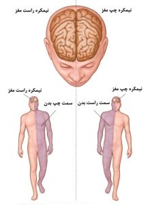 اقدامات فیزیوتراپی در درمان سکته مغزی