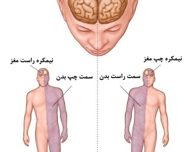 اقدامات فیزیوتراپی در درمان سکته مغزی