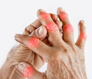 تفاوت بین آرتروز مفصلی و روماتیسم مفصلی