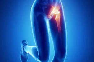 علت درد کشاله ران در کودکان دختر