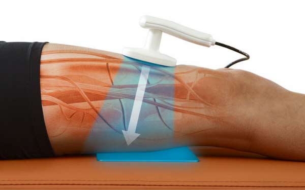 آیا درد کمر شما نیاز به فیزیوتراپی دارد؟ راهنمایی برای ساکنان رشت