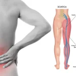 اعصاب ناحیه خاجی (ساکرال) چیست؟