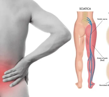 اعصاب ناحیه خاجی (ساکرال) چیست؟