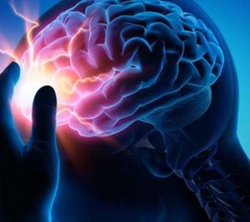 فیزیوتراپی عصبی (نورولوژیک)