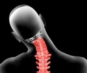 آیا دنده گردنی خطرناک است؟