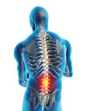 ضایعه نخاعی چیست؟