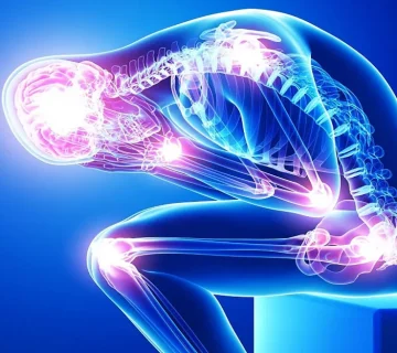 مشکلات اسکلتی-عضلانی