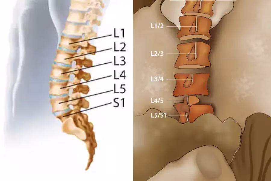دیسک کمر را با چه حرکات ورزشی باید تقویت کرد؟ (راهنمای گام‌به‌گام)