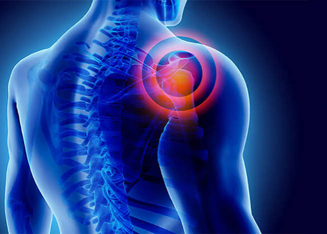 شانه درد چیست و چگونه با فیزیوتراپی درمان می‌شود؟