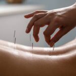 طب سوزنی در کنار فیزیوتراپی در رشت؛ مکملی برای تسریع درمان