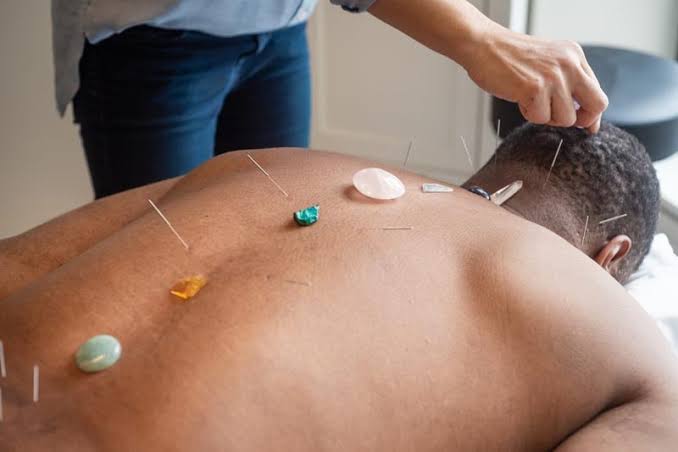 طب سوزنی در فیزیوتراپی در رشت؛ چگونه درد را کاهش می‌دهد؟
