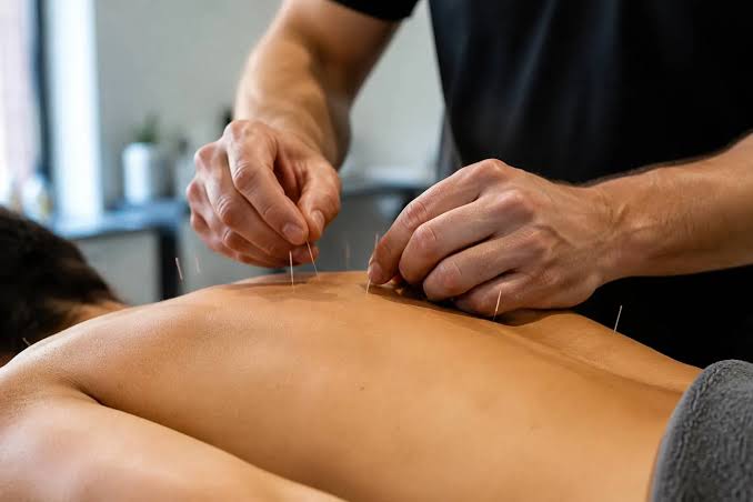 تفاوت طب سوزنی سنتی و طب سوزنی در فیزیوتراپی مدرن در رشت