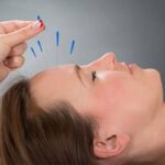 تفاوت طب سوزنی سنتی و طب سوزنی در فیزیوتراپی مدرن در رشت