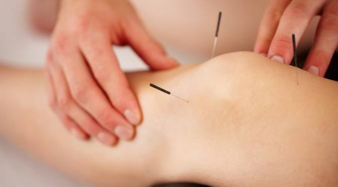 طب سوزنی در رشت برای رفع جای جوش و زخم؛ واقعیت یا تبلیغ؟