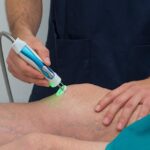 فیزیوتراپی بعد از جراحی زانو در رشت؛ مراحل بازگشت به فعالیت